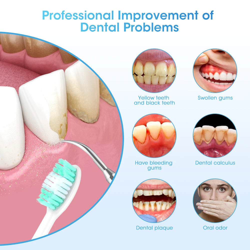 High Frequency Teeth Cleaner: Electric, Tartar & Plaque Removal