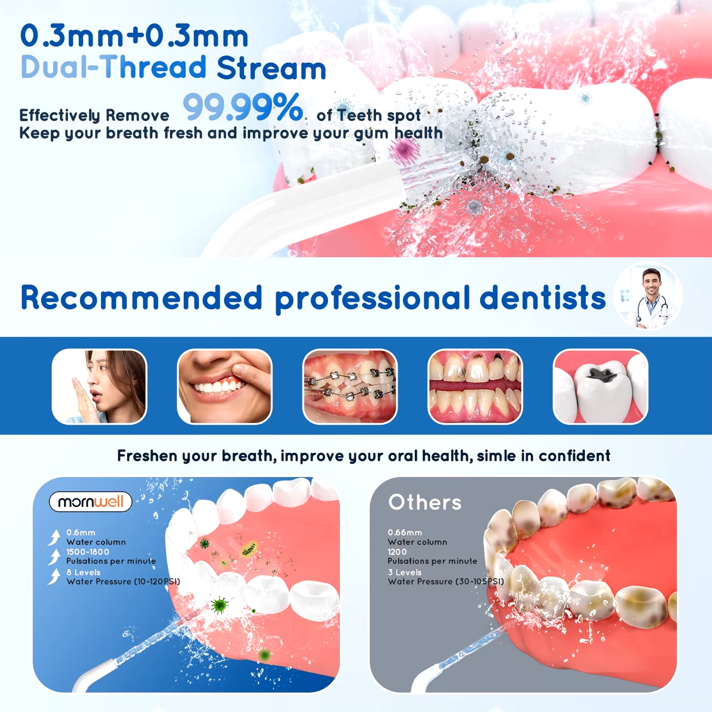 D52 Portable Water Flosser: 3 Modes, 4 Jet Tips, 300ml, USB Rechargeable