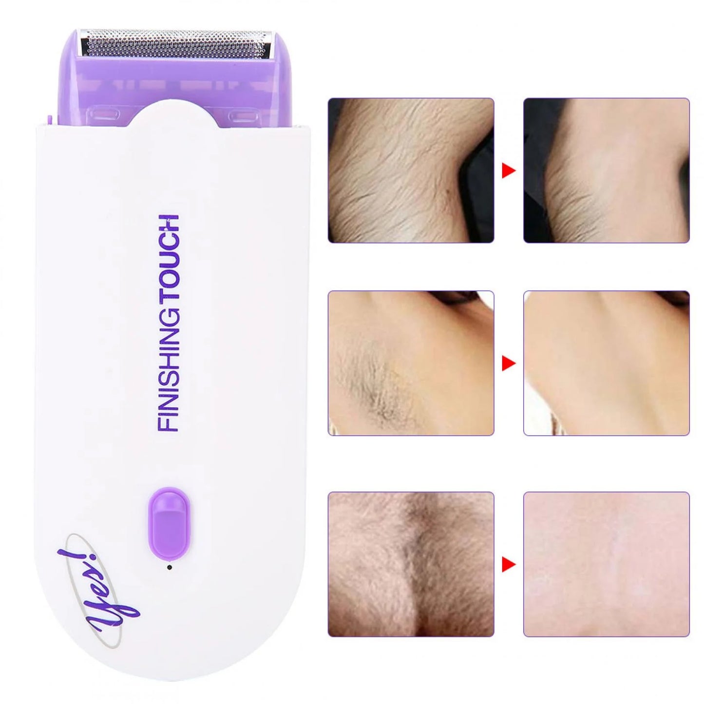 Brrnoo Hair Remover, Dual Use Hair Removal Machine, Armpit for Face