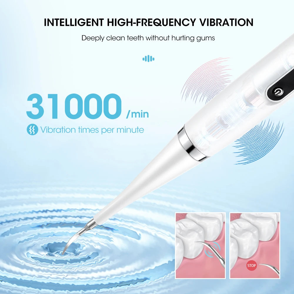 High Frequency Teeth Cleaner: Electric, Tartar & Plaque Removal