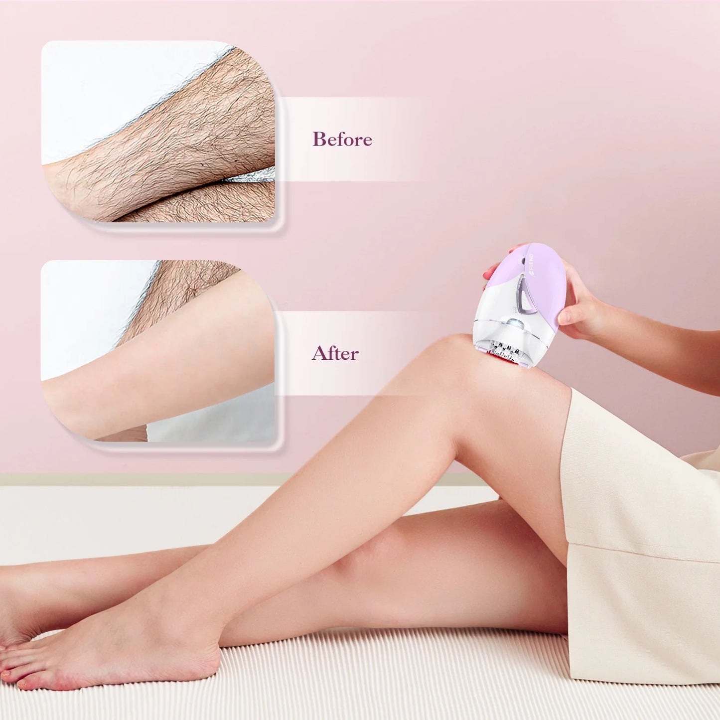 Hair Epilator Removal for Women, USB Rechargeable Hair Remover Electric Tweezers, Cordless Epilator for Women Face Hair Remover with Light,Hair Rmoval with Portable and Compact Design