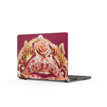Matte Laptop Case – Kiss of Gold