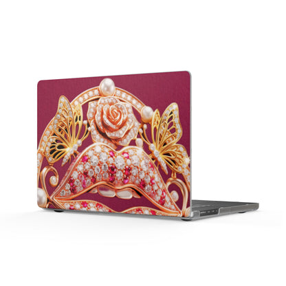 Matte Laptop Case – Kiss of Gold