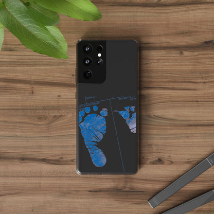 Clear Phone Case – Mom’s Little Blue Footprints