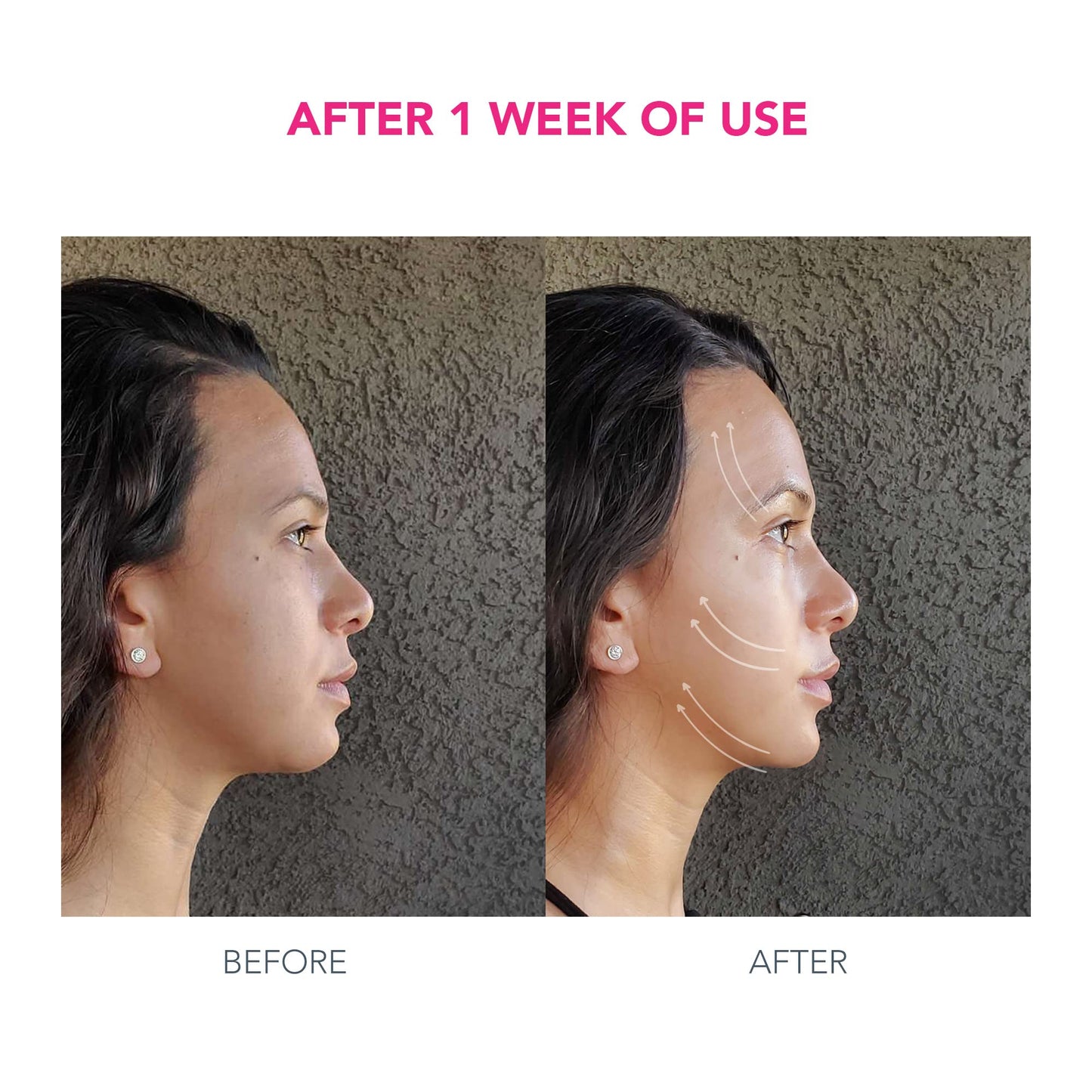 FOREO BEAR Microcurrent Face Lift Set – FDA-Cleared Sculpting Device, T-Sonic Pulsations, 2 x 30mL Conductive Serums