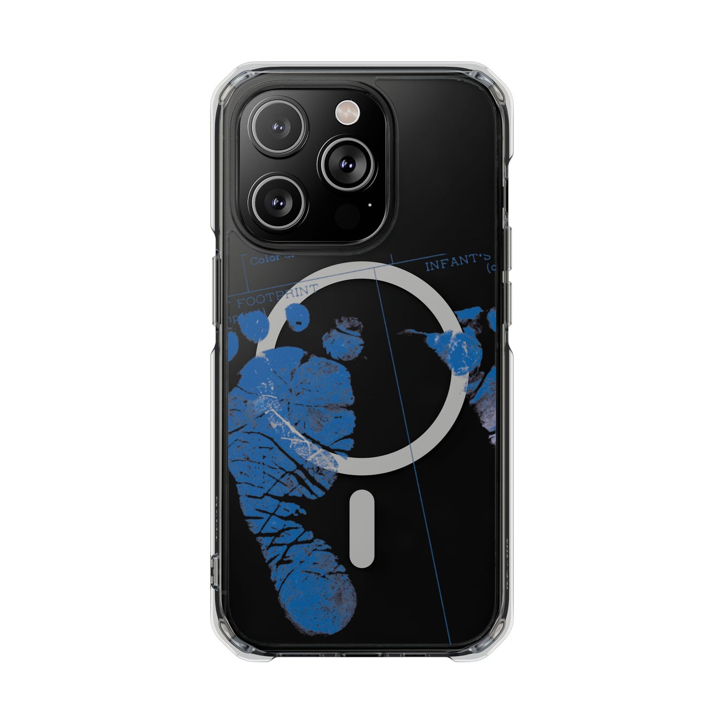 Clear Magnetic Phone Case – Mom’s Little Blue Footprints