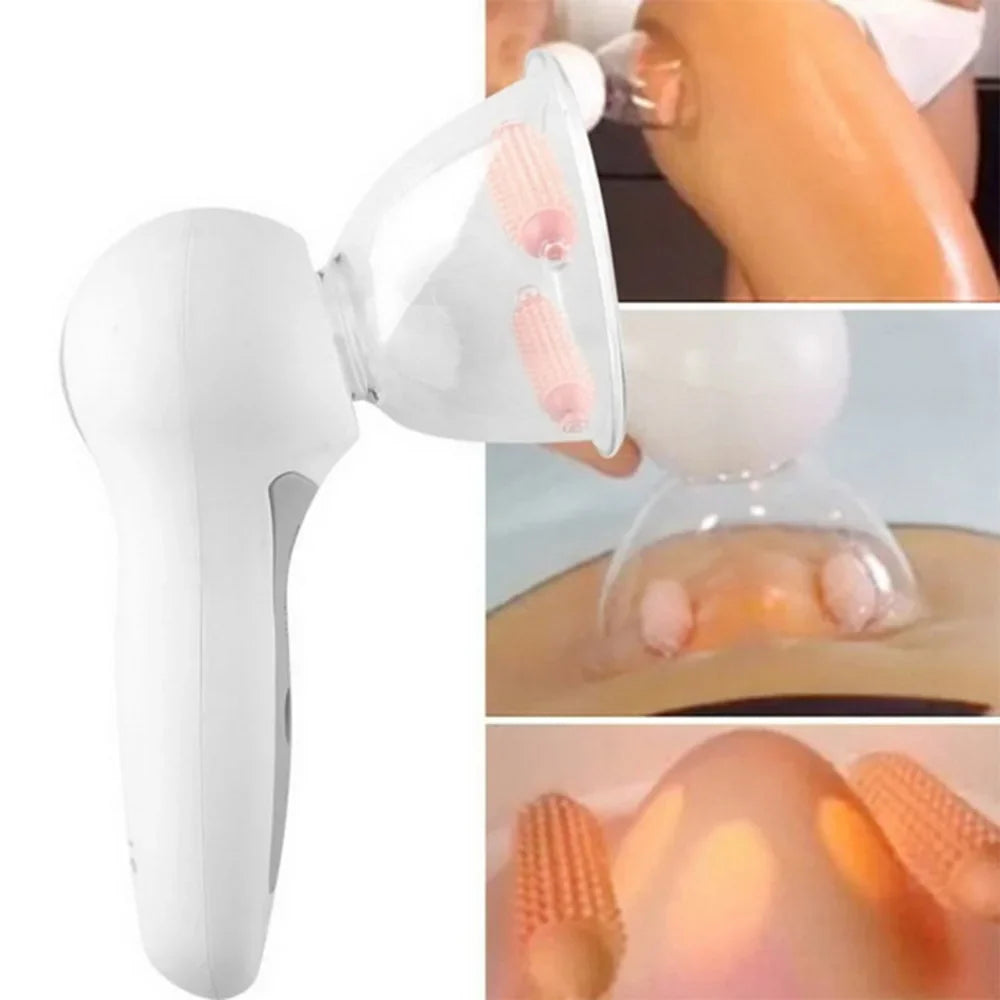 MD Ergo Body Suction Massager – Firming Skin Tool, Adjustable Suction, Dual & Single Roller Cups